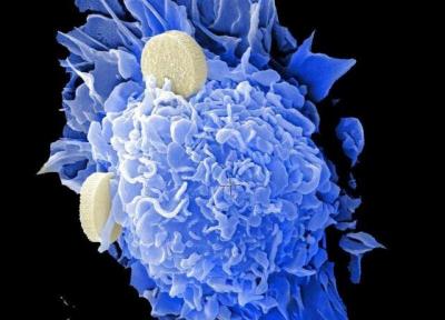 مهار متاستاز سرطان روده عظیم با یاری یک مولکول کوچک